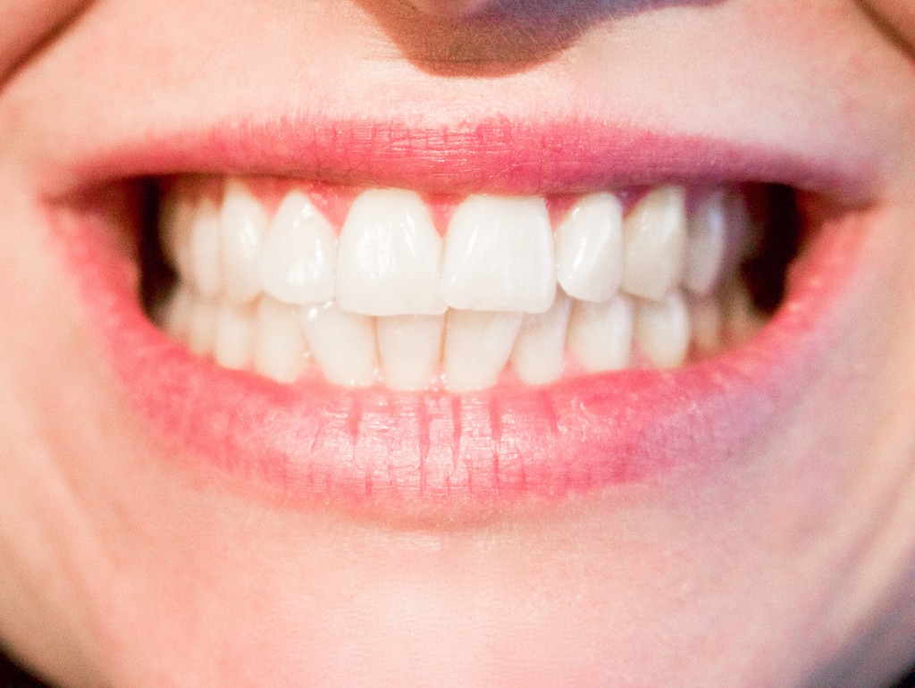teeth-smile