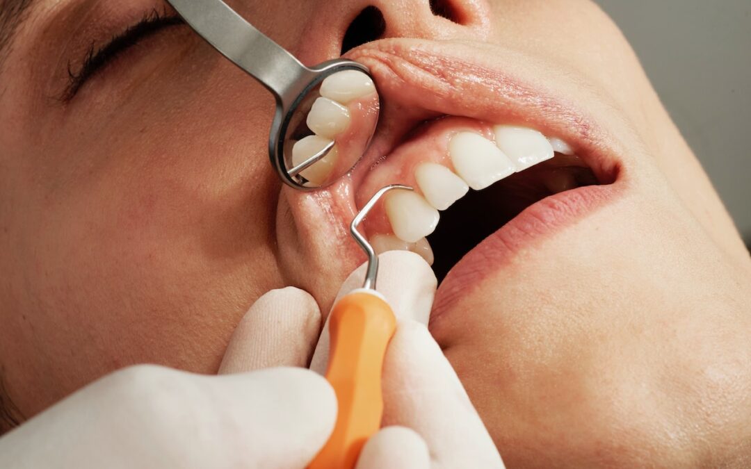 What Are the Most Common Teeth Problems?