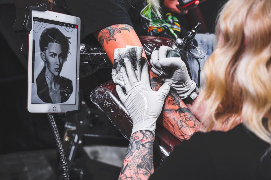 Tattoo Regret? Here's What You Need to Know About Removal Services