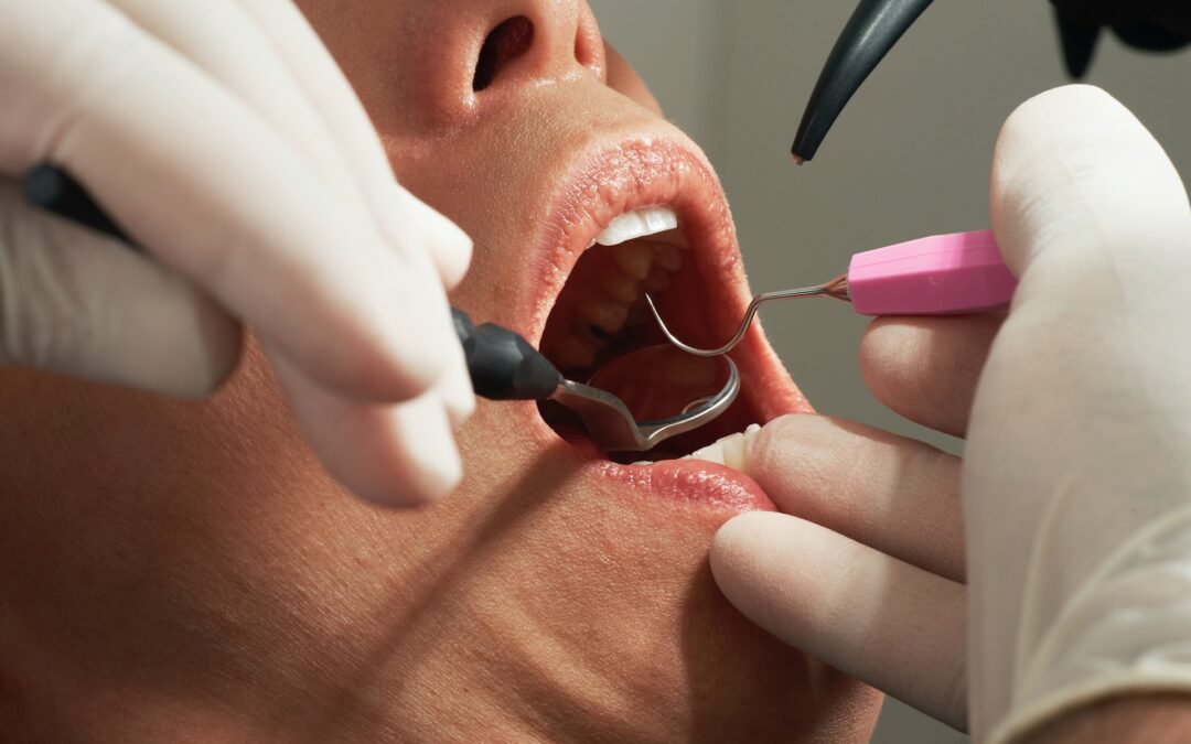 Exploring the World of General Dentistry
